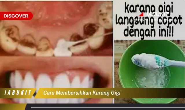 cara membersihkan karang gigi