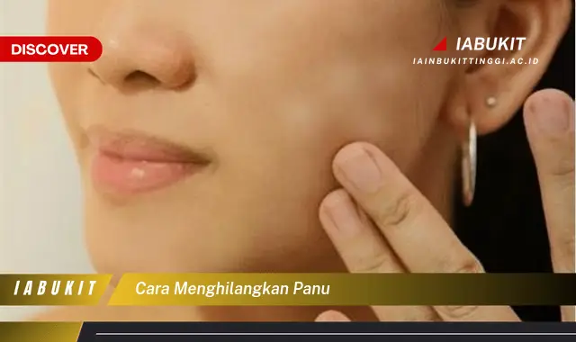 cara menghilangkan panu