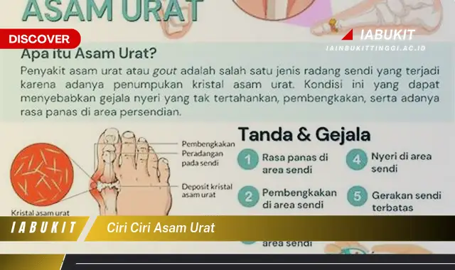 Intip Ciri-ciri Asam Urat yang Jarang Diketahui