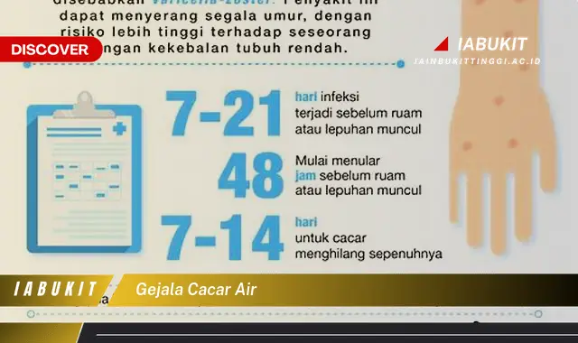 gejala cacar air gejala cacar air