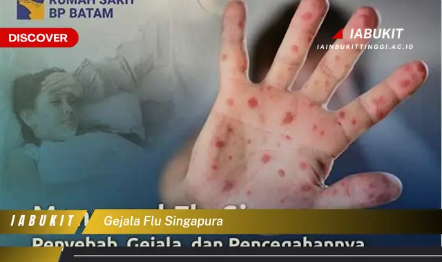 gejala flu singapura