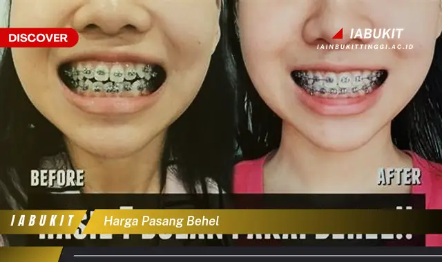 harga pasang behel