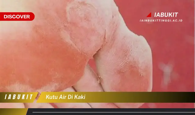 kutu air di kaki kutu air di kaki