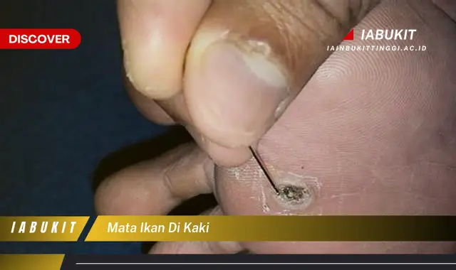 mata ikan di kaki