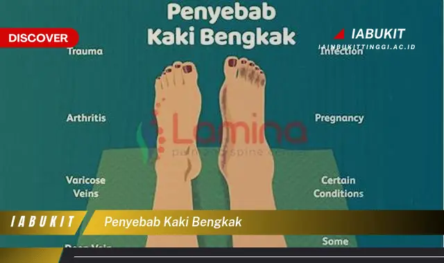 penyebab kaki bengkak