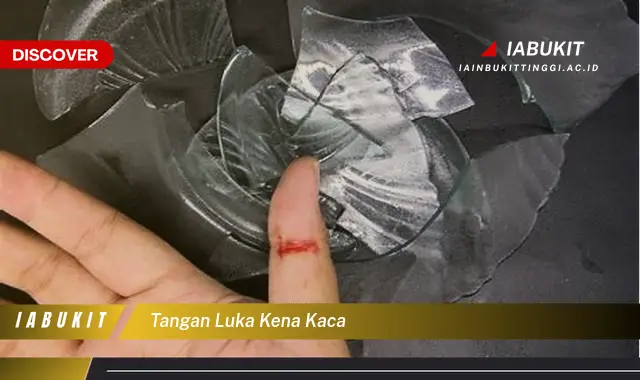 tangan luka kena kaca