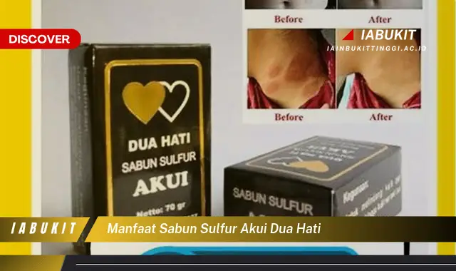 manfaat sabun sulfur akui dua hati