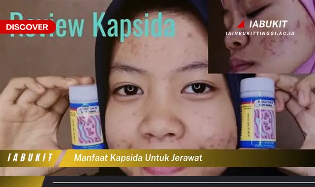 manfaat kapsida untuk jerawat manfaat kapsida untuk jerawat