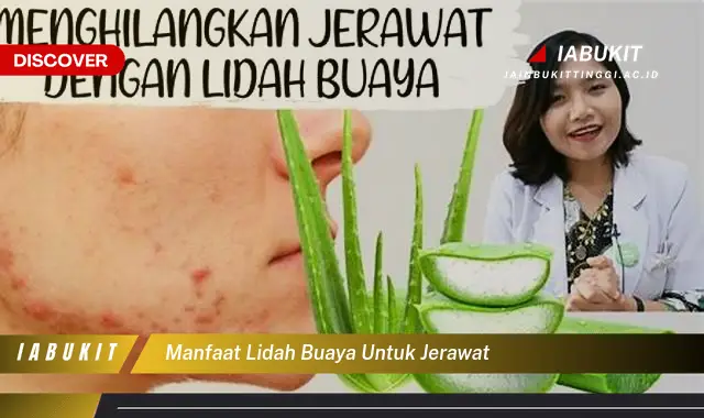 manfaat lidah buaya untuk jerawat