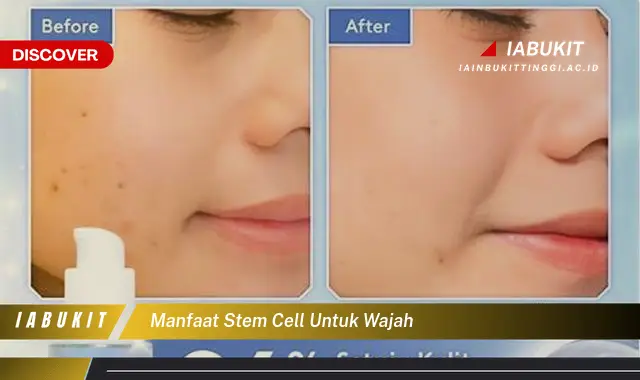 manfaat stem cell untuk wajah