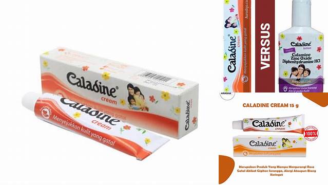 Temukan Manfaat Caladine Cream yang Jarang Diketahui, Raih Kulit Sehat Sempurna!