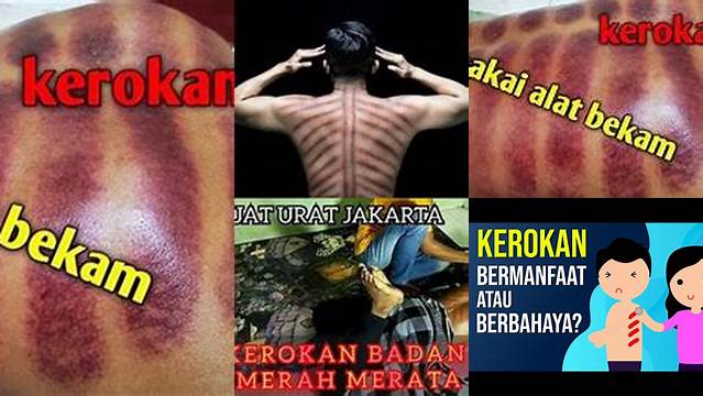 Temukan Manfaat Tersembunyi Kerok Badan yang Jarang Diketahui