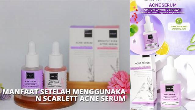 Manfaat Serum Scarlett Acne Terbukti, Jarang Diketahui!