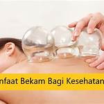 Temukan Manfaat Bekam yang Jarang Diketahui demi Kesehatan yang Optimal