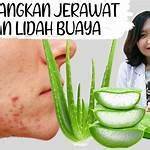 manfaat lidah buaya untuk kompres benjolan