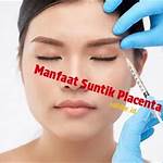 manfaat suntik placenta di wajah